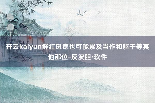 开云kaiyun鲜红斑痣也可能累及当作和躯干等其他部位-反波胆·软件